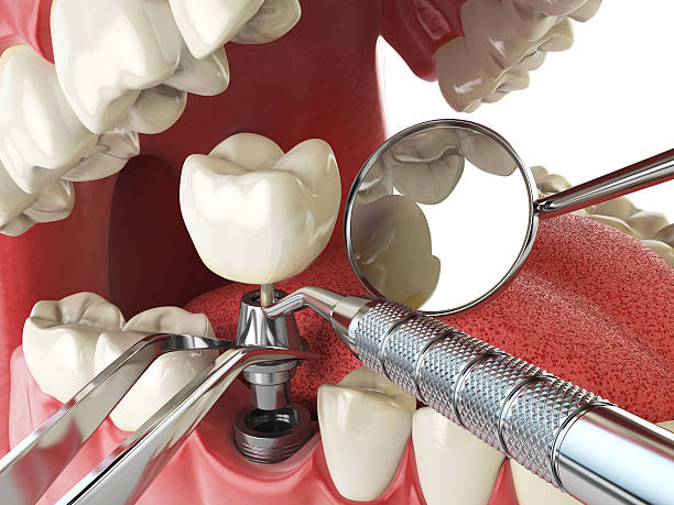 Best Knocked-Out Tooth Emergency  in Boaz, AL